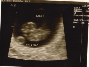 ultrasound 2014-09-24 improved 1.jpg